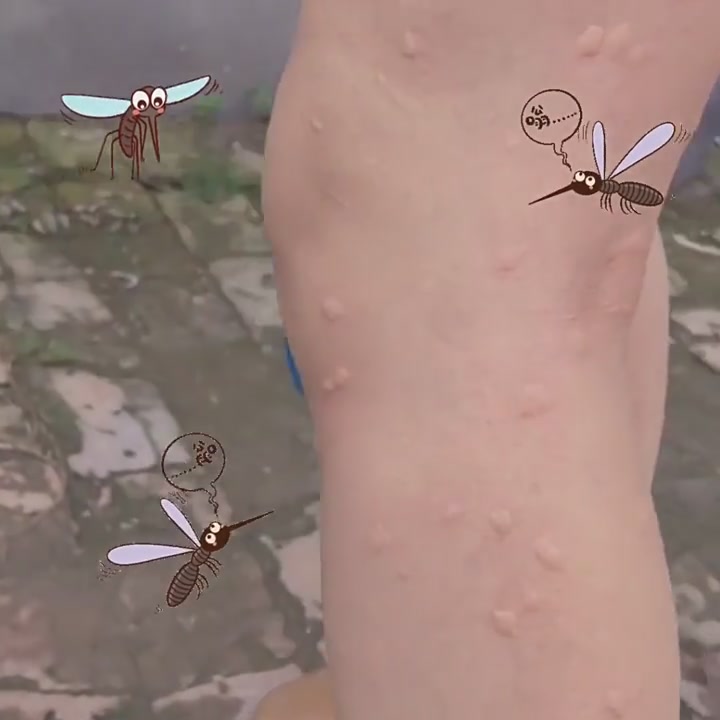 兴宛堂艾草叮叮消：夏日防蚊新神器，滚珠一抹就止痒！