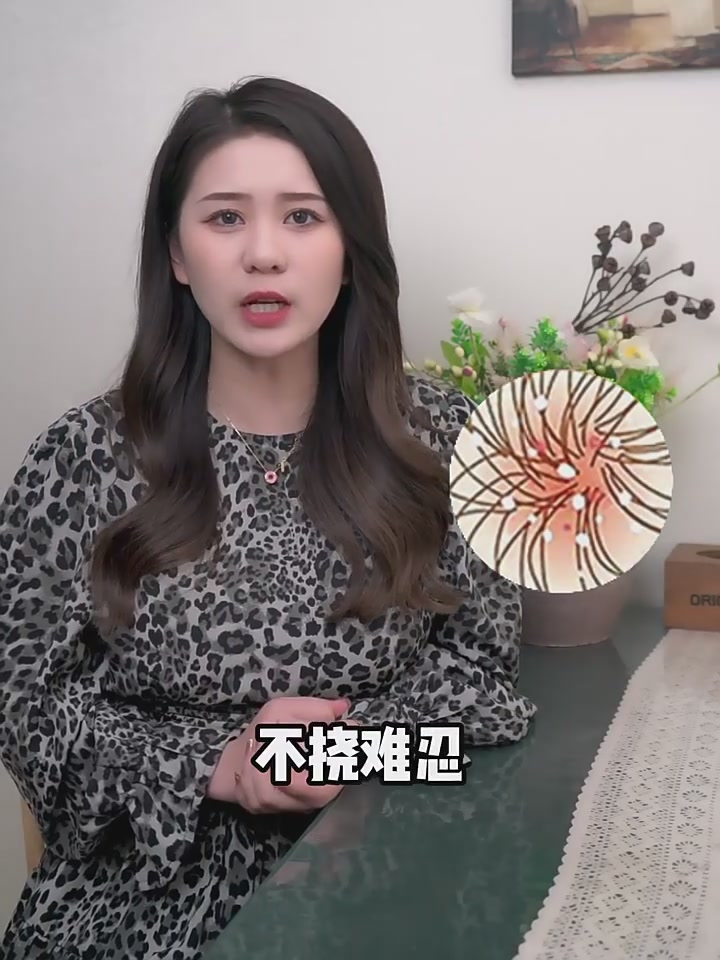 油头救星！欧柏意bioblas洗发水，我的头皮终于能呼吸了！