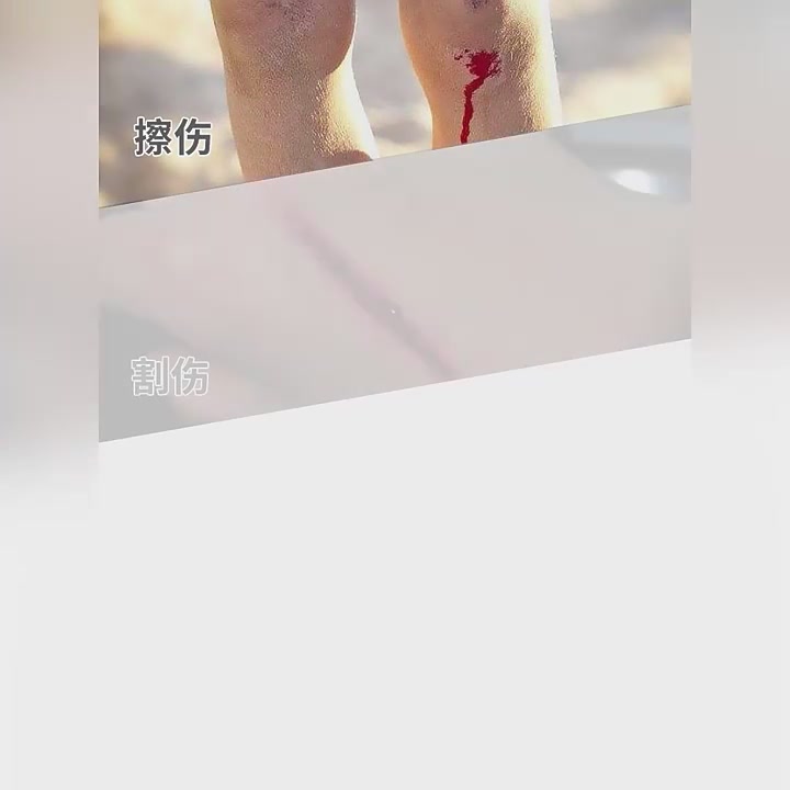 伤口护理必备！这款银离子喷剂真的绝了，无色无味还杀菌！