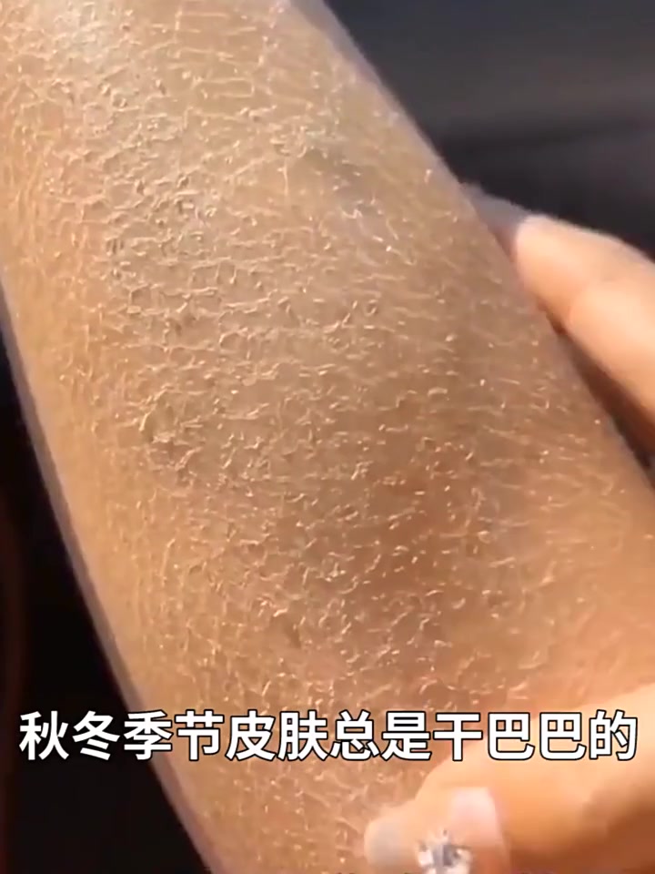 49块买来的白松露身体乳，真的能去鸡皮？我替你们试了！